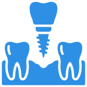 Dental implant illustration between two teeth