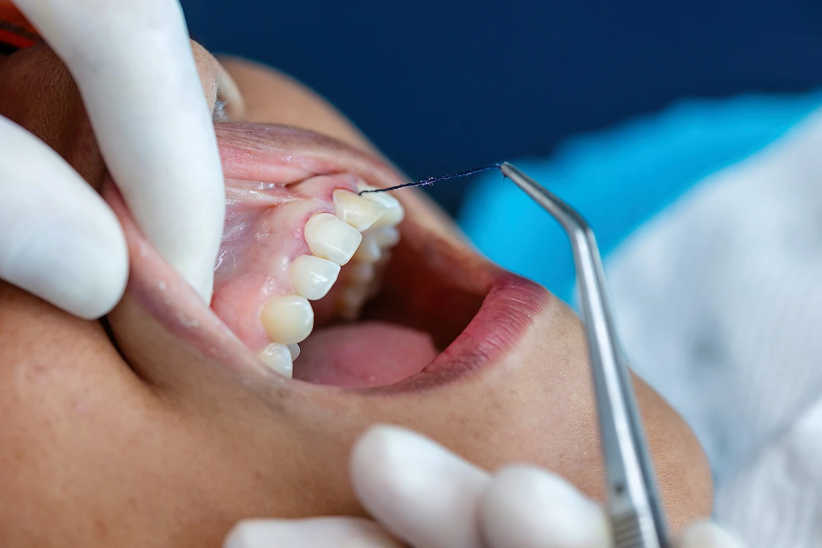 Dentist flossing patient's teeth